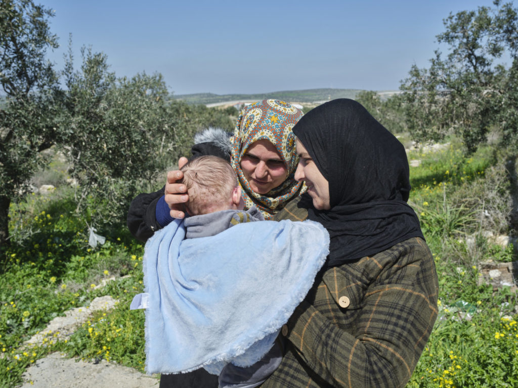 La mamma di Yousef Sweiti riceve istruzioni da Mariam Darrabi’ – madre di un altro bambino farfalla.